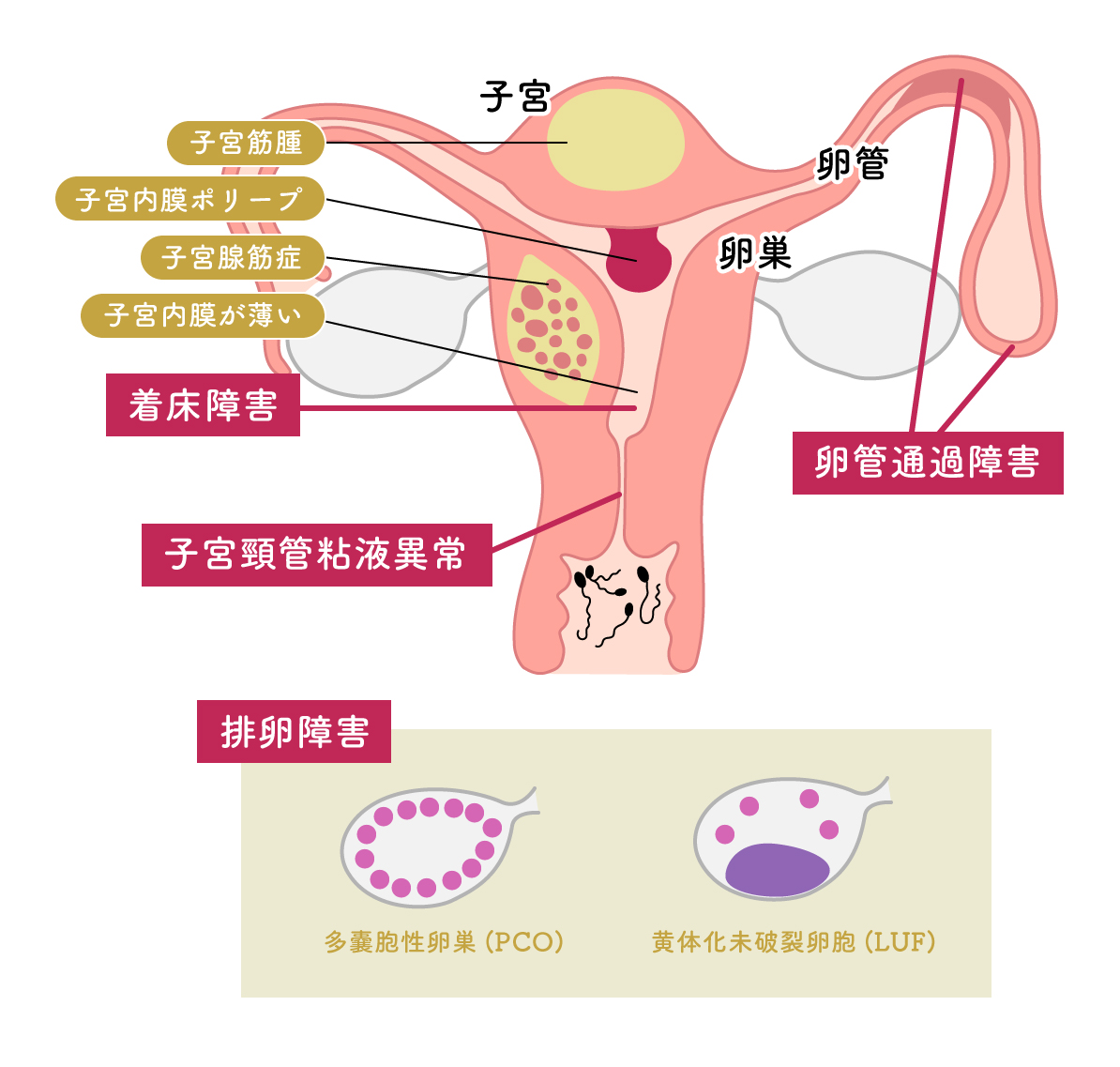 女性の原因