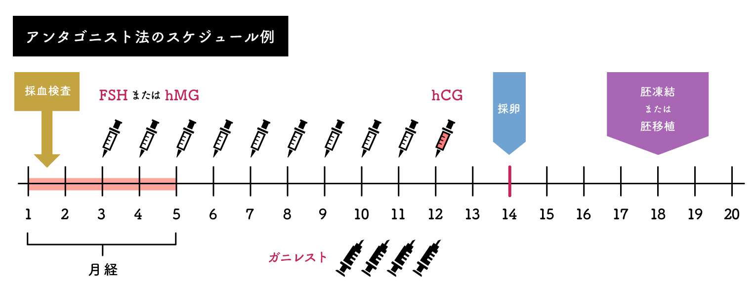 アンタゴニスト法