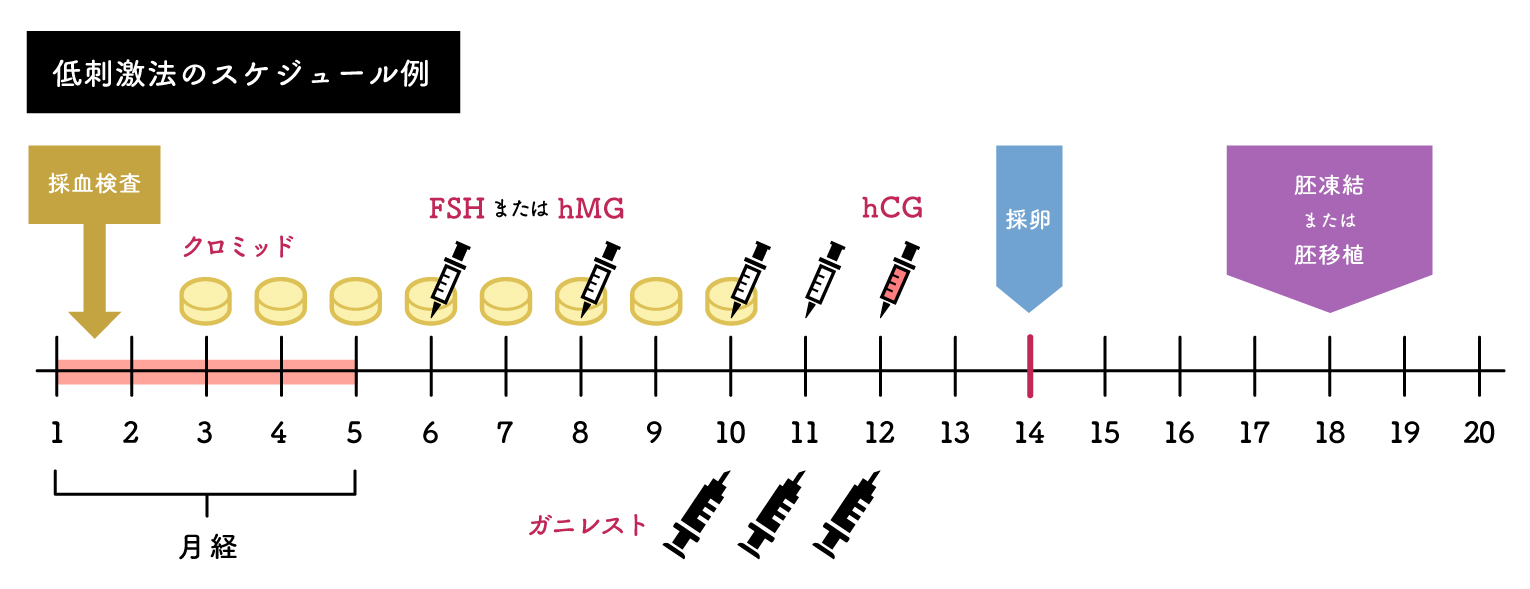 クロミッド＋hMG/FSH