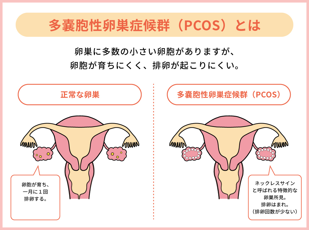 イラスト5
